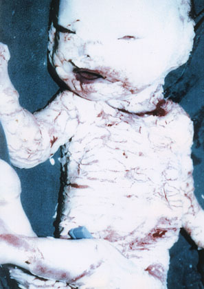Obvious deformation of face and                                                                                                                                         eyes.  ... next picture ...