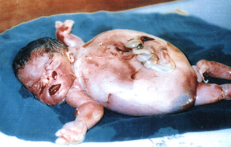 Severe body deformity ... ... next picture ...