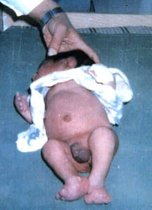  another 'Non Viable' child ... ... next picture ...