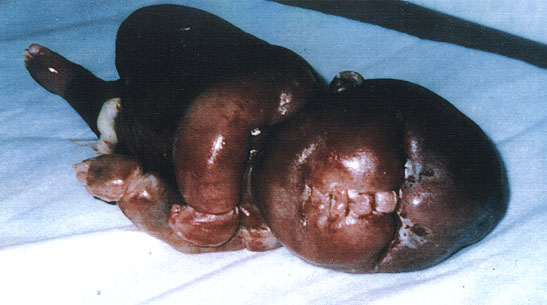 Horrendous deformity of entire body and head ... ... next picture