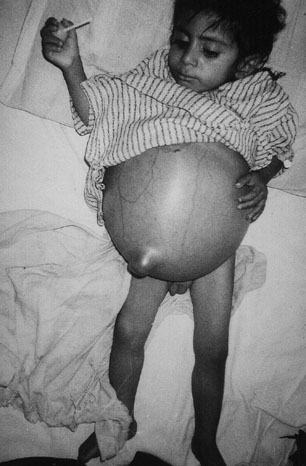 Child with previously unknown renal disease